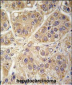 SARS2 Antibody (Center)
